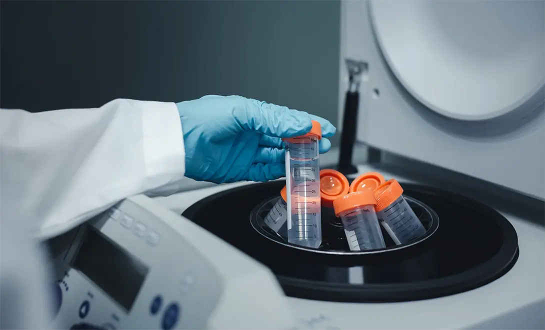 small peptide-Centrifuge small peptide-Centrifuge